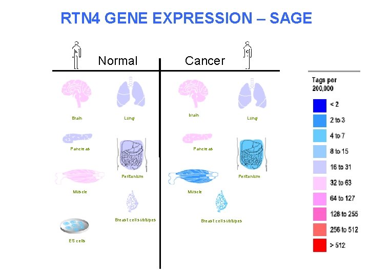 RTN 4 GENE EXPRESSION – SAGE Normal Brain Lung Pancreas Cancer brain Lung Pancreas