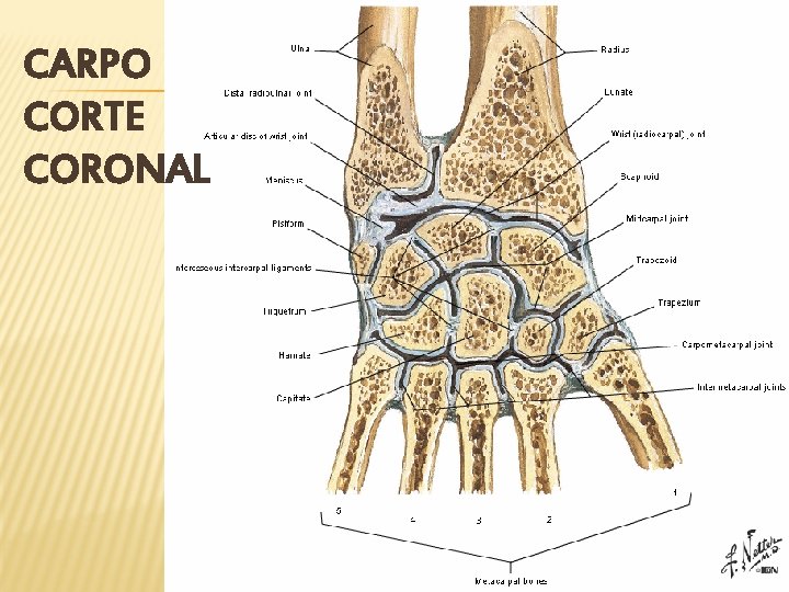 CARPO CORTE CORONAL 