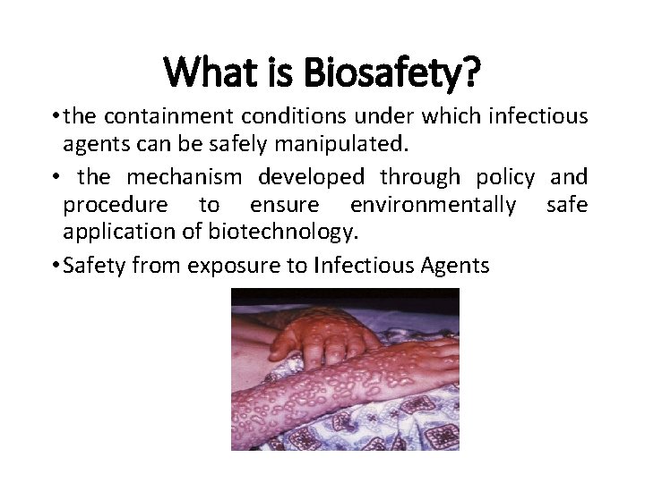 What is Biosafety? • the containment conditions under which infectious agents can be safely