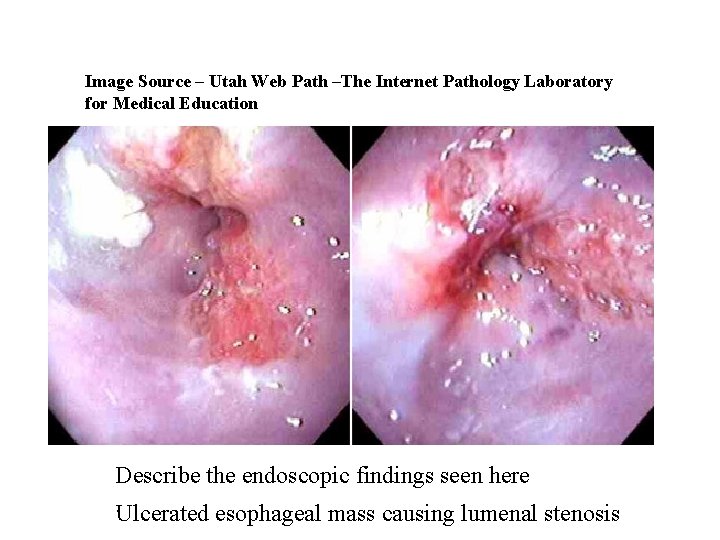 Image Source – Utah Web Path –The Internet Pathology Laboratory for Medical Education Describe