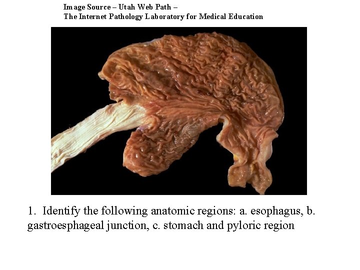 Image Source – Utah Web Path – The Internet Pathology Laboratory for Medical Education