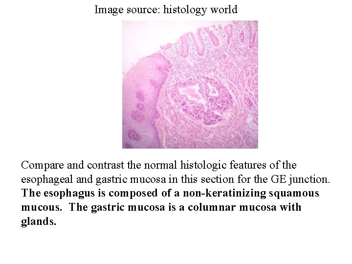 Image source: histology world Compare and contrast the normal histologic features of the esophageal