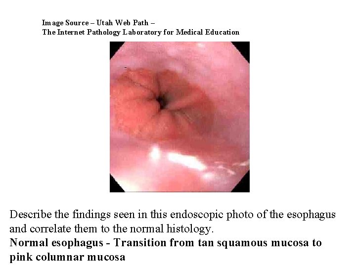 Image Source – Utah Web Path – The Internet Pathology Laboratory for Medical Education