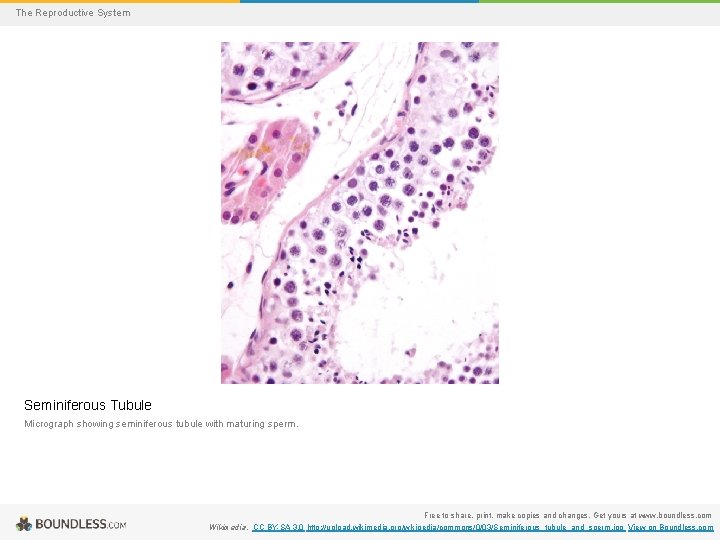 The Reproductive System Seminiferous Tubule Micrograph showing seminiferous tubule with maturing sperm. Free to