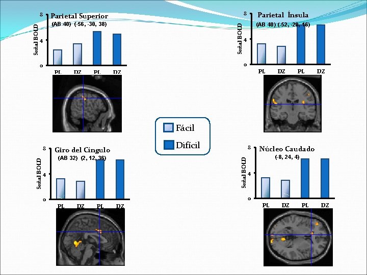8 Parietal Superior (AB 40) (-56, -30, 38) Señal BOLD 8 4 Parietal Ínsula