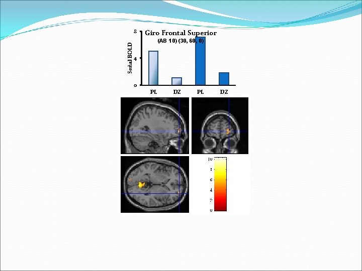 Señal BOLD 8 Giro Frontal Superior (AB 10) (30, 60, 0) 4 0 PL