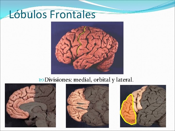 Lóbulos Frontales Divisiones: medial, orbital y lateral. 