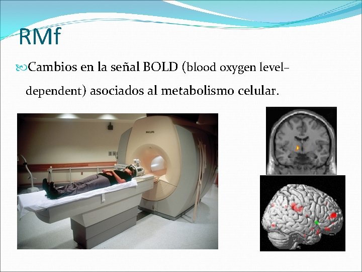 RMf Cambios en la señal BOLD (blood oxygen level– dependent) asociados al metabolismo celular.