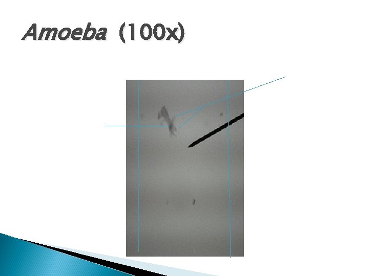 Amoeba (100 x) 