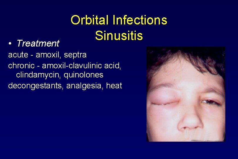  • Treatment Orbital Infections Sinusitis acute - amoxil, septra chronic - amoxil-clavulinic acid,