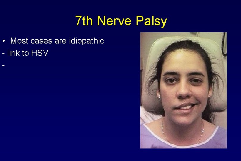 7 th Nerve Palsy • Most cases are idiopathic - link to HSV -