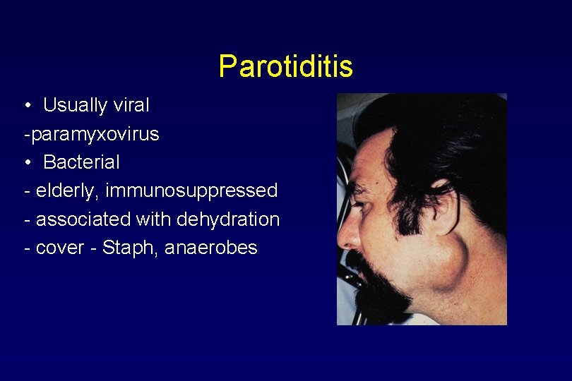 Parotiditis • Usually viral -paramyxovirus • Bacterial - elderly, immunosuppressed - associated with dehydration