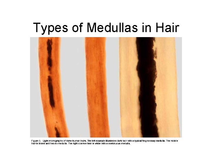 Types of Medullas in Hair 