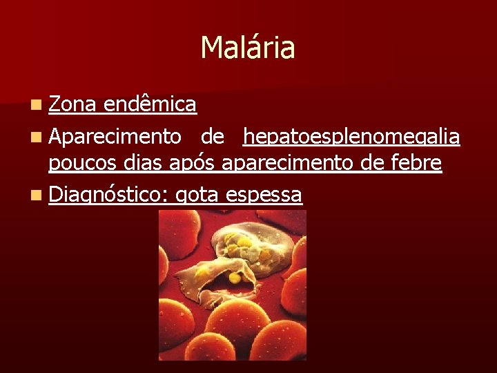 Malária n Zona endêmica n Aparecimento de hepatoesplenomegalia poucos dias após aparecimento de febre