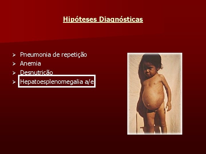 Hipóteses Diagnósticas Pneumonia de repetição Ø Anemia Ø Desnutrição Ø Hepatoesplenomegalia a/e Ø 