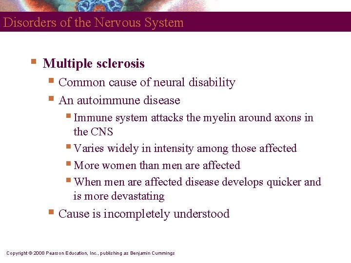 Disorders of the Nervous System § Multiple sclerosis § Common cause of neural disability