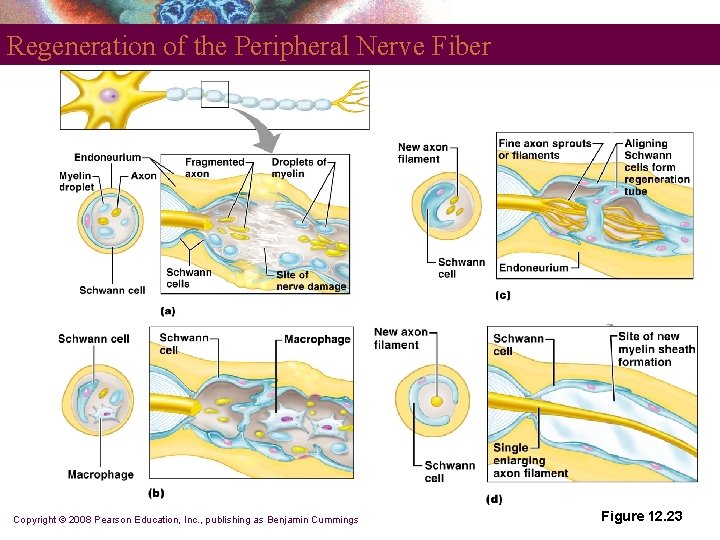 Regeneration of the Peripheral Nerve Fiber Copyright © 2008 Pearson Education, Inc. , publishing