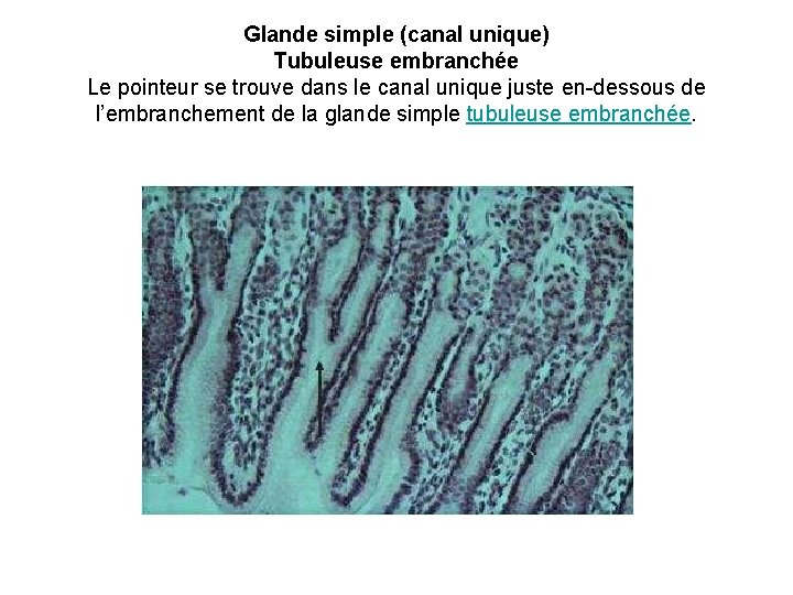 Glande simple (canal unique) Tubuleuse embranchée Le pointeur se trouve dans le canal unique