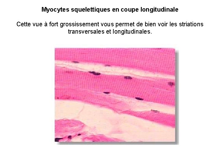 Myocytes squelettiques en coupe longitudinale Cette vue à fort grossissement vous permet de bien