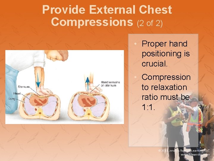 Provide External Chest Compressions (2 of 2) • Proper hand positioning is crucial. •