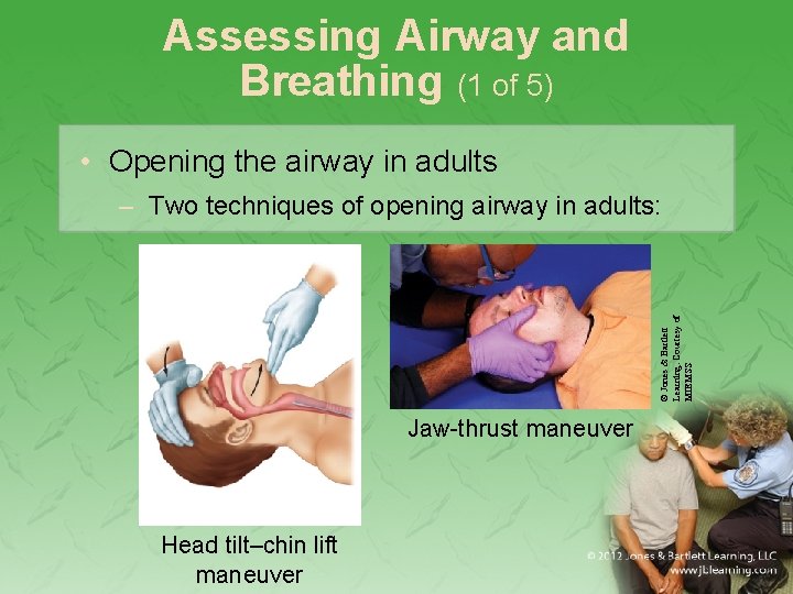 Assessing Airway and Breathing (1 of 5) • Opening the airway in adults ©