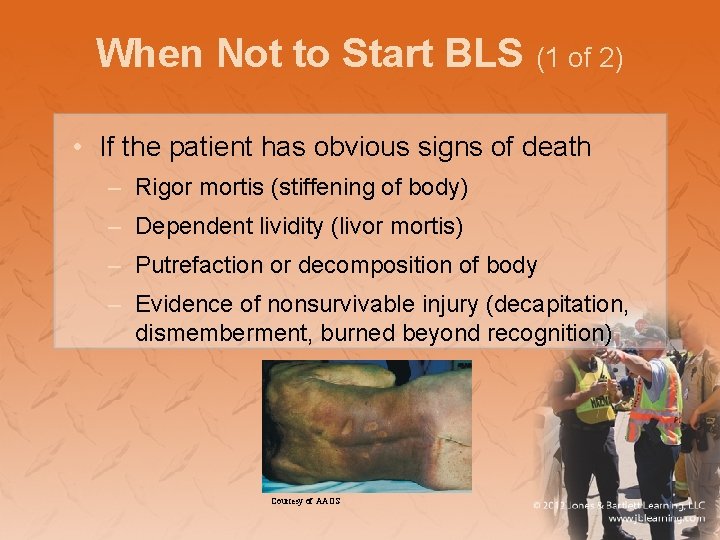 When Not to Start BLS (1 of 2) • If the patient has obvious