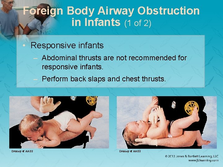 Foreign Body Airway Obstruction in Infants (1 of 2) • Responsive infants – Abdominal