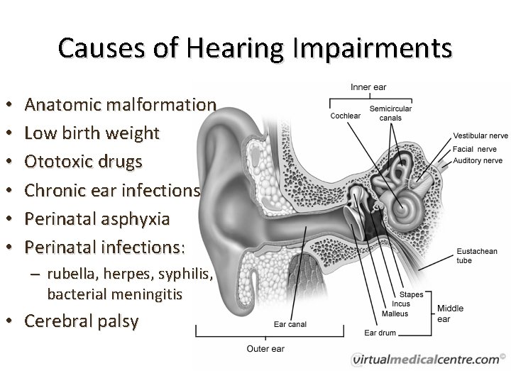 Causes of Hearing Impairments • • • Anatomic malformation Low birth weight Ototoxic drugs