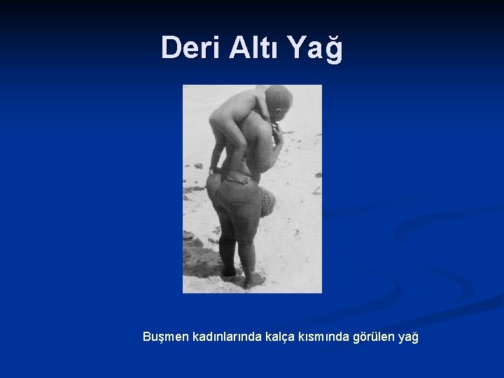 Deri Altı Yağ Buşmen kadınlarında kalça kısmında görülen yağ 
