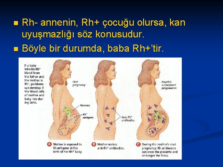 Rh- annenin, Rh+ çocuğu olursa, kan uyuşmazlığı söz konusudur. n Böyle bir durumda, baba