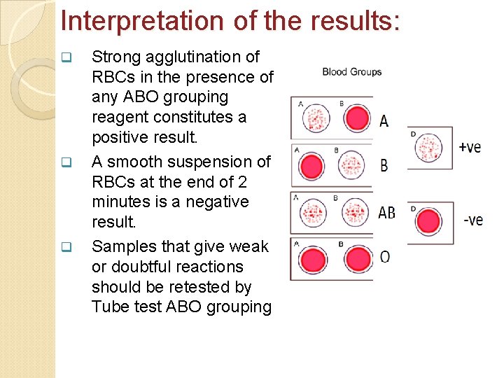 Interpretation of the results: q q q Strong agglutination of RBCs in the presence