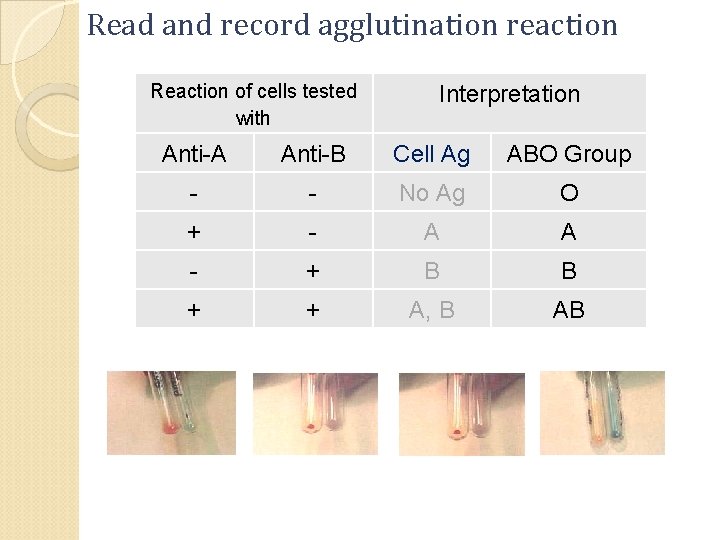 Read and record agglutination reaction Reaction of cells tested with Interpretation Anti-A Anti-B Cell