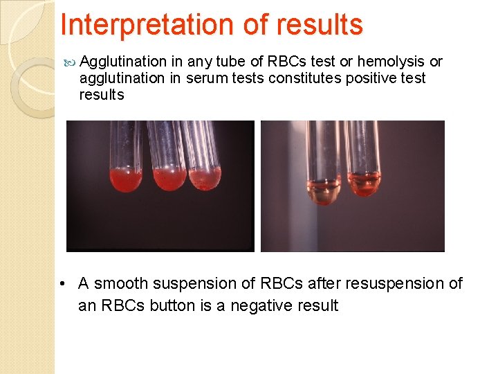 Interpretation of results Agglutination in any tube of RBCs test or hemolysis or agglutination