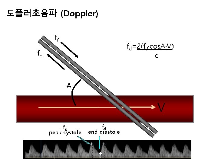 도플러초음파 (Doppler) f 0 fd=2(f 0·cos. A·V) c fd A V fd peak systole