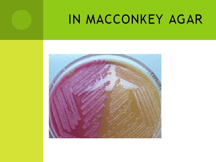 IN MACCONKEY AGAR 