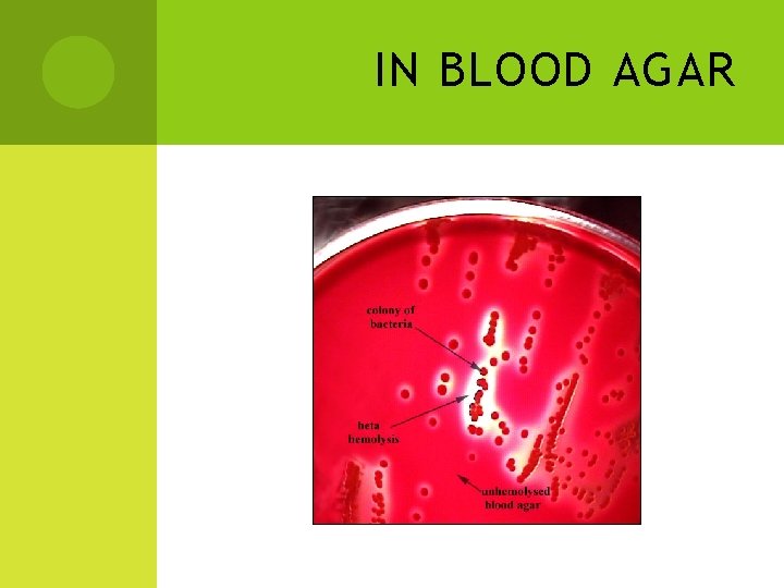 IN BLOOD AGAR 