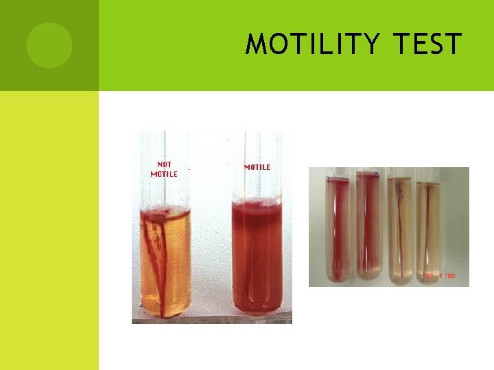 MOTILITY TEST 