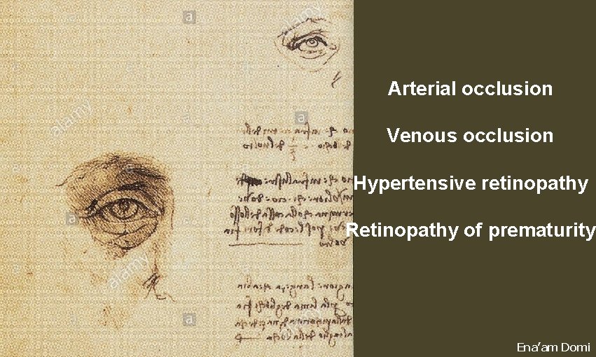 Arterial occlusion Venous occlusion Hypertensive retinopathy Retinopathy of prematurity Ena’am Domi 