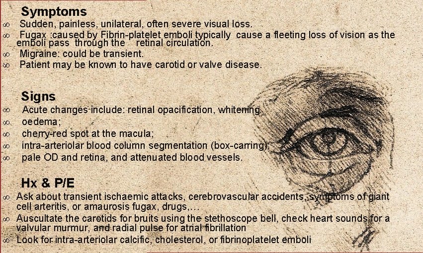 Symptoms ∞ Sudden, painless, unilateral, often severe visual loss. ∞ Fugax : caused by