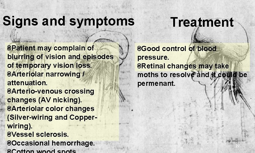 Signs and symptoms ₴Patient may complain of blurring of vision and episodes of temporary