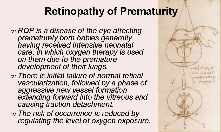 Retinopathy of Prematurity ∞ ROP is a disease of the eye affecting prematurely born