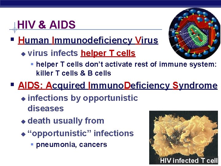 HIV & AIDS § Human Immunodeficiency Virus u virus infects helper T cells §