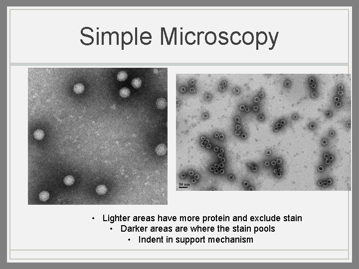 Simple Microscopy • Lighter areas have more protein and exclude stain • Darker areas