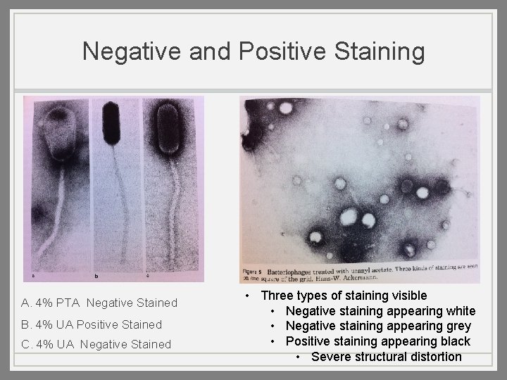 Negative and Positive Staining A. 4% PTA Negative Stained B. 4% UA Positive Stained