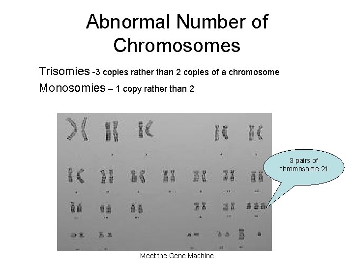 Abnormal Number of Chromosomes Trisomies -3 copies rather than 2 copies of a chromosome