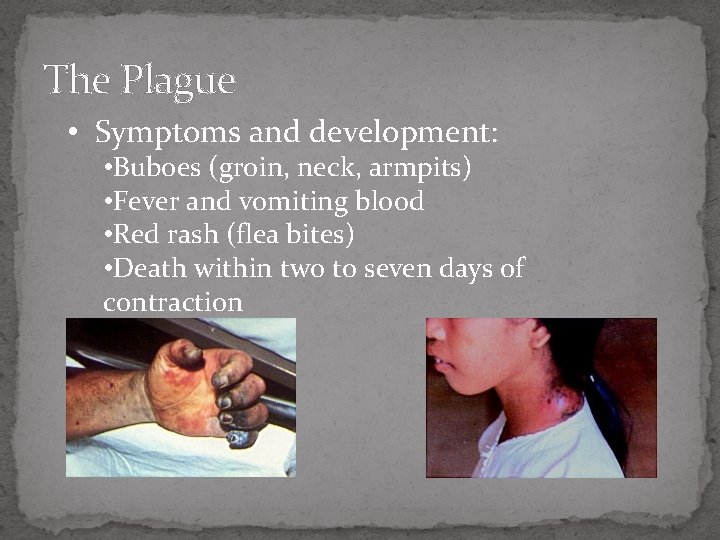The Plague • Symptoms and development: • Buboes (groin, neck, armpits) • Fever and
