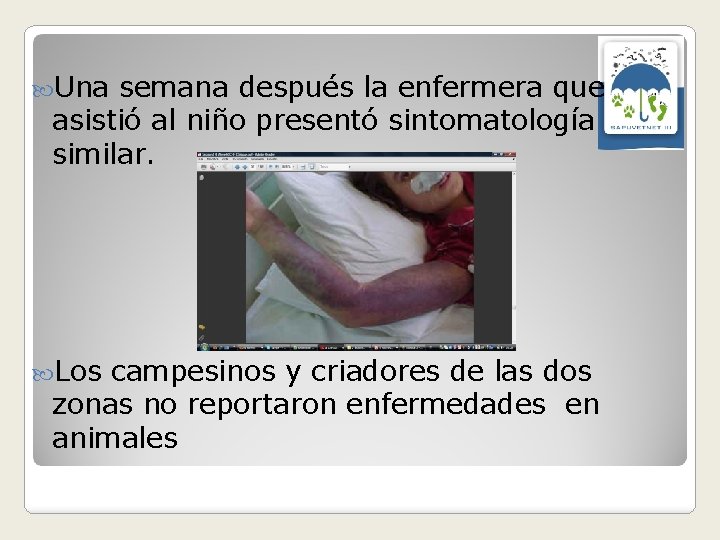  Una semana después la enfermera que asistió al niño presentó sintomatología similar. Los