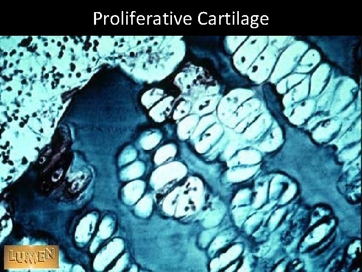Proliferative Cartilage 