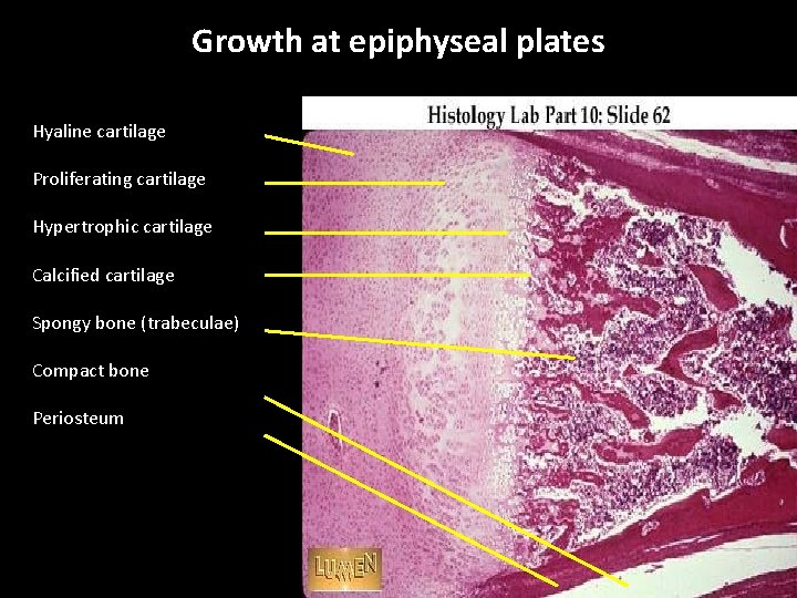 Growth at epiphyseal plates Hyaline cartilage Proliferating cartilage Hypertrophic cartilage Calcified cartilage Spongy bone