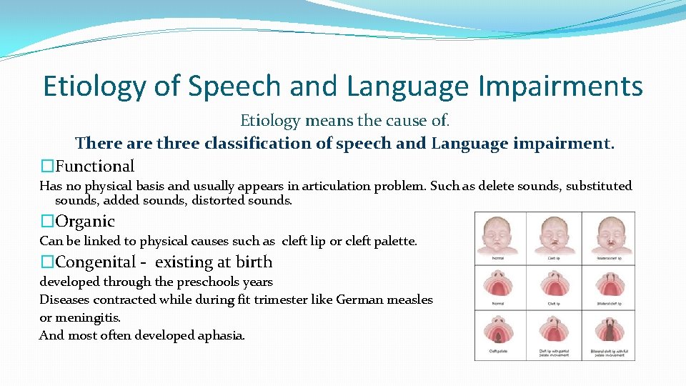 Etiology of Speech and Language Impairments Etiology means the cause of. There are three